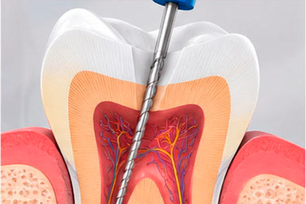 Endodontia