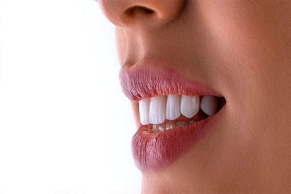 Estética Bucal