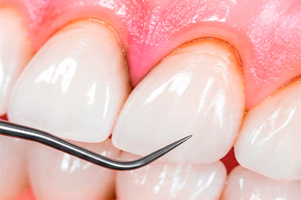 Periodontia