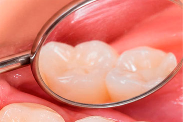 Dentística